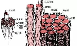 横纹肌溶解综合征